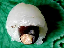 litchi